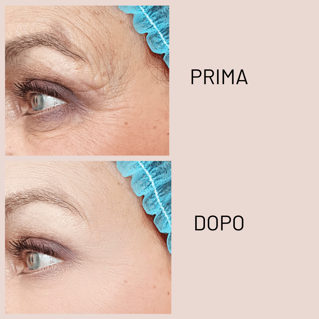 Smoothing Eye Cream - KOREALUX® - Skincare