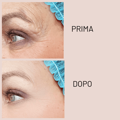 Smoothing Eye Cream - KOREALUX® - Skincare