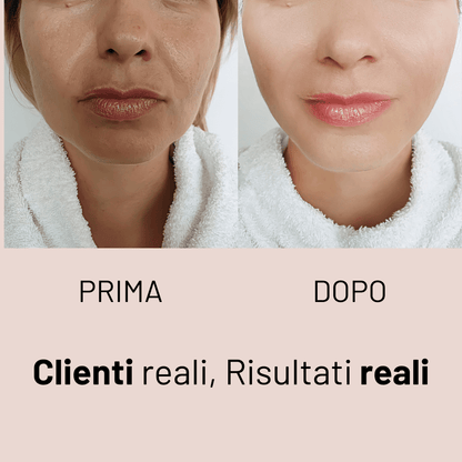 Hyaluronic Anti-Age Cream - KOREALUX® - Skincare
