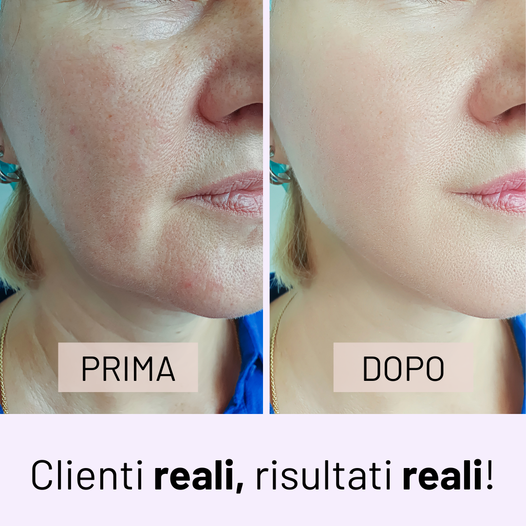 Eternal - Siero al Bakuchiol