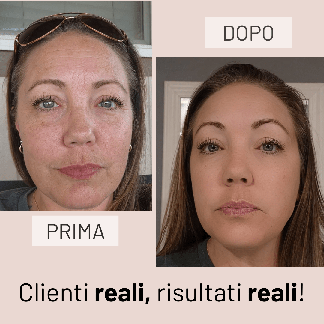 Peptide Serum - KOREALUX® - Skincare