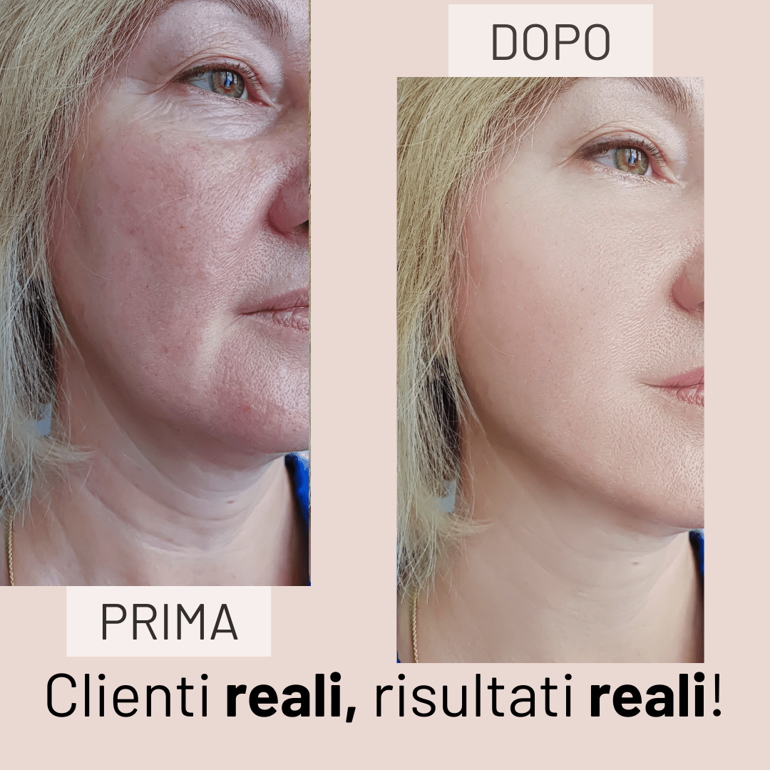 Collagen Boost Serum - KOREALUX® - Skincare